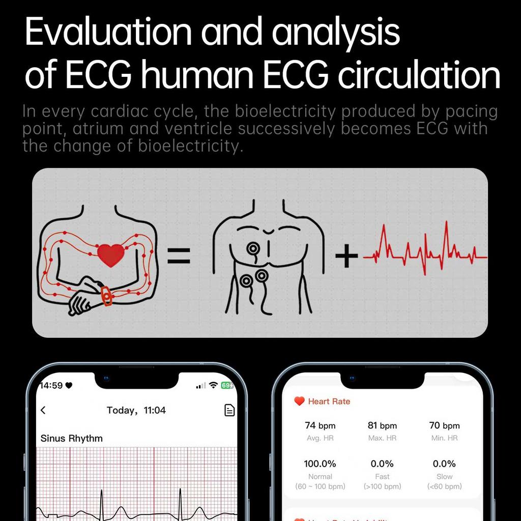 2025 НОВЫЕ Смарт-часы для микрофизического обследования здоровья ЭКГ АД Кислород крови Мочевая кислота Жир крови Температура Вызов по Bluetooth Умные часы