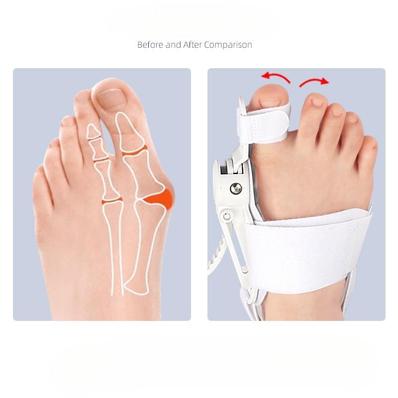 Hallux Valgus Corrector For Men and Women, Adjustable Toe Straightener White