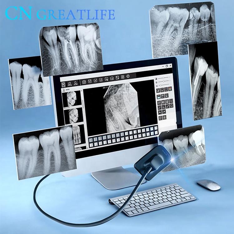 Ветеринарные клиники, система стоматологической визуализации, внутриротовой цифровой рентгеновский датчик REFINE, стоматологический рентгеновский датчик, стоматологический датчик Rvg
