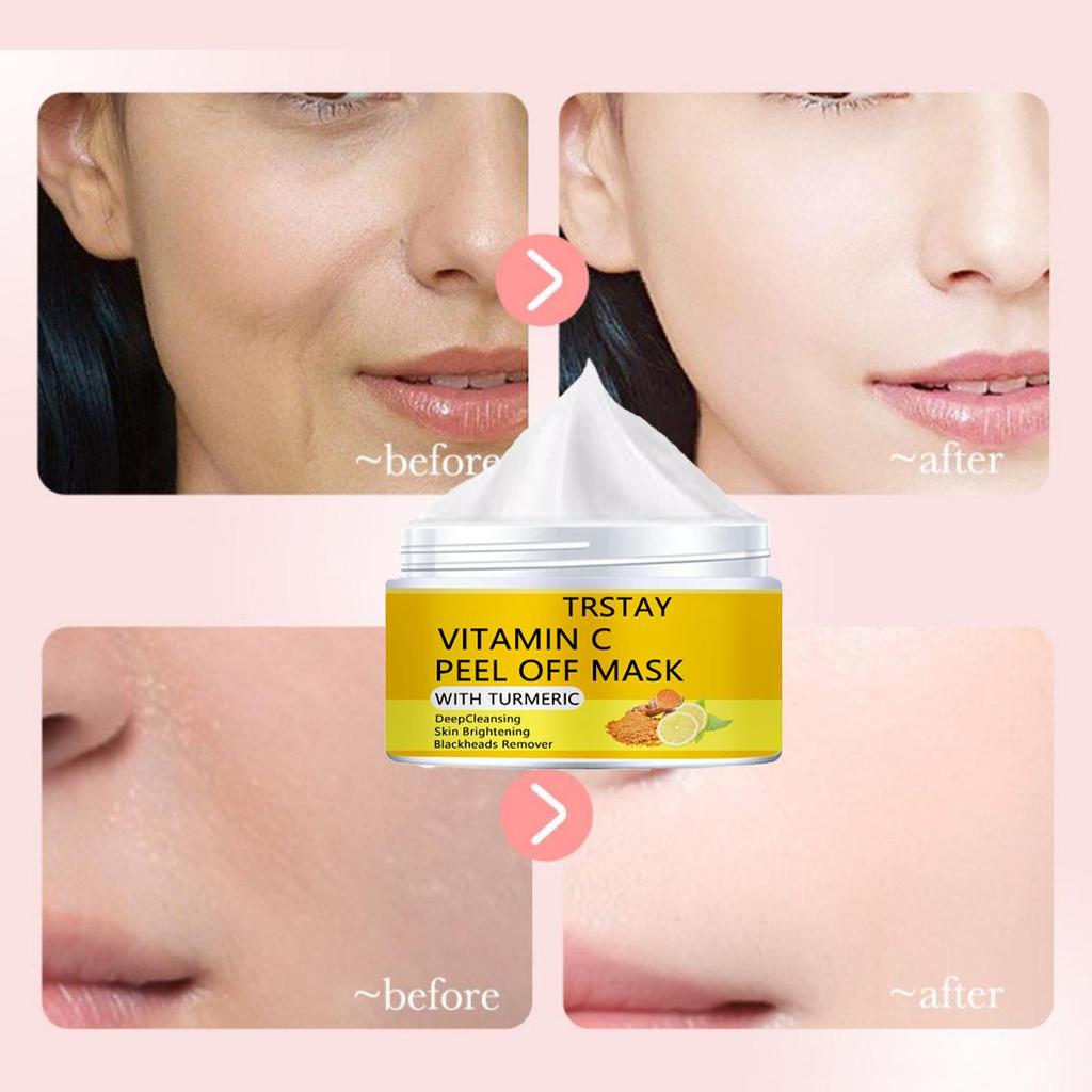 Осветляющий и полупрозрачный крем для кожи с пигментными пятнами, мягкое увлажнение без раздражения, уменьшает мелкие морщины, увлажняет кожу и улучшает состояние поврежденной кожи.