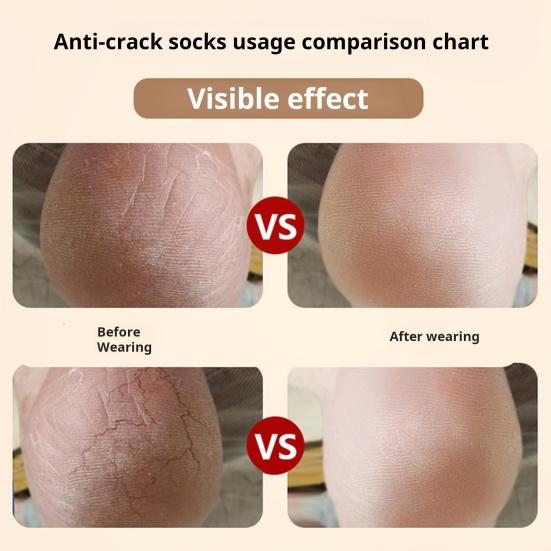 1 пара увлажняющих силиконовых носков для ремонта потрескавшихся пяток, носки без пальцев, высокоэластичные спа-гелевые носки для сухих потрескавшихся ног, увлажняющий лосьон