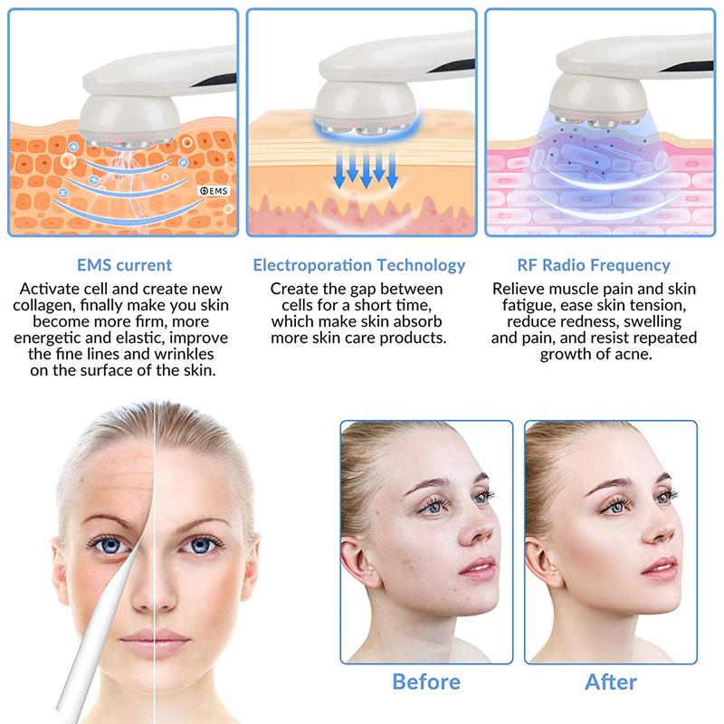 KinseiBeauty EMS светодиодный фотонный массажер мезотерапия электропорация радиочастотное устройство для ухода за кожей лица подтяжка лица подтяжка косметическая машина
