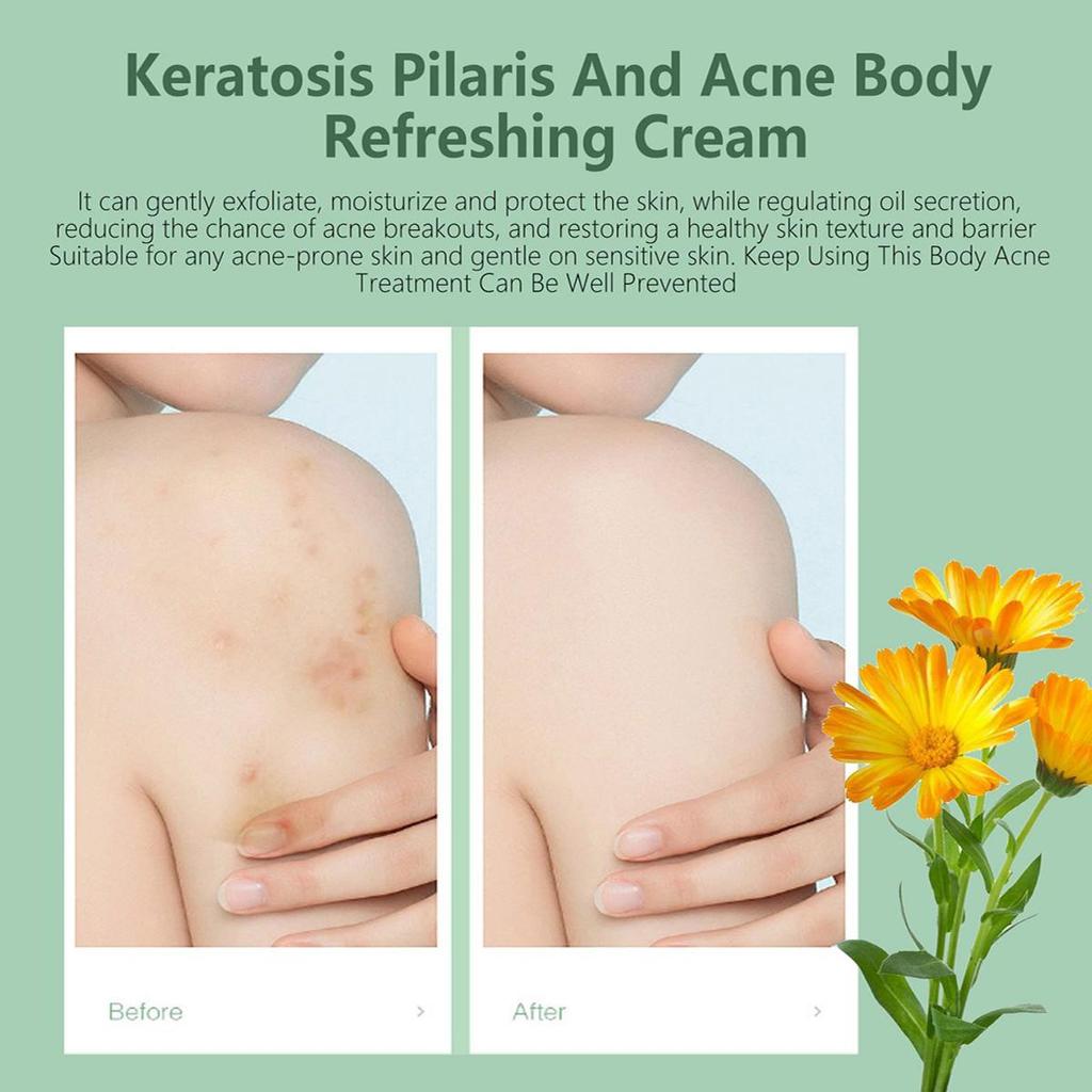 Отбеливающий крем для кожи, контролирующий жирность кожи, маскирующий поры, отбеливающий кожу от прыщей