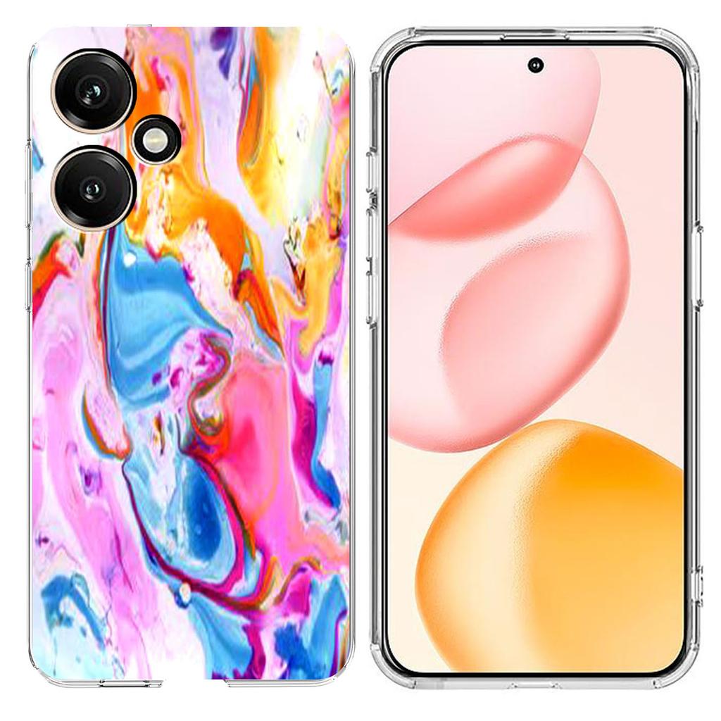 Для Honor 400 5G (Глобальный) Чехол Печать Мраморный Узор Мягкий ТПУ Чехол для Телефона