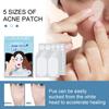 80Pcs/Set Acne Patches with Tea Tree Oil Cover Acne Scars Ultra Thin Pimple Patch Invisible Acne Spot Face Care