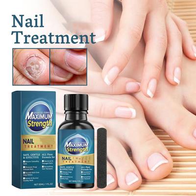 N Ail Treatment N Ail Treatment Nail Treatment Toenail Care, Быстродействующая жидкость для ухода за ногтями для всего восстанавливает здоровый вид ногтей 30 мл