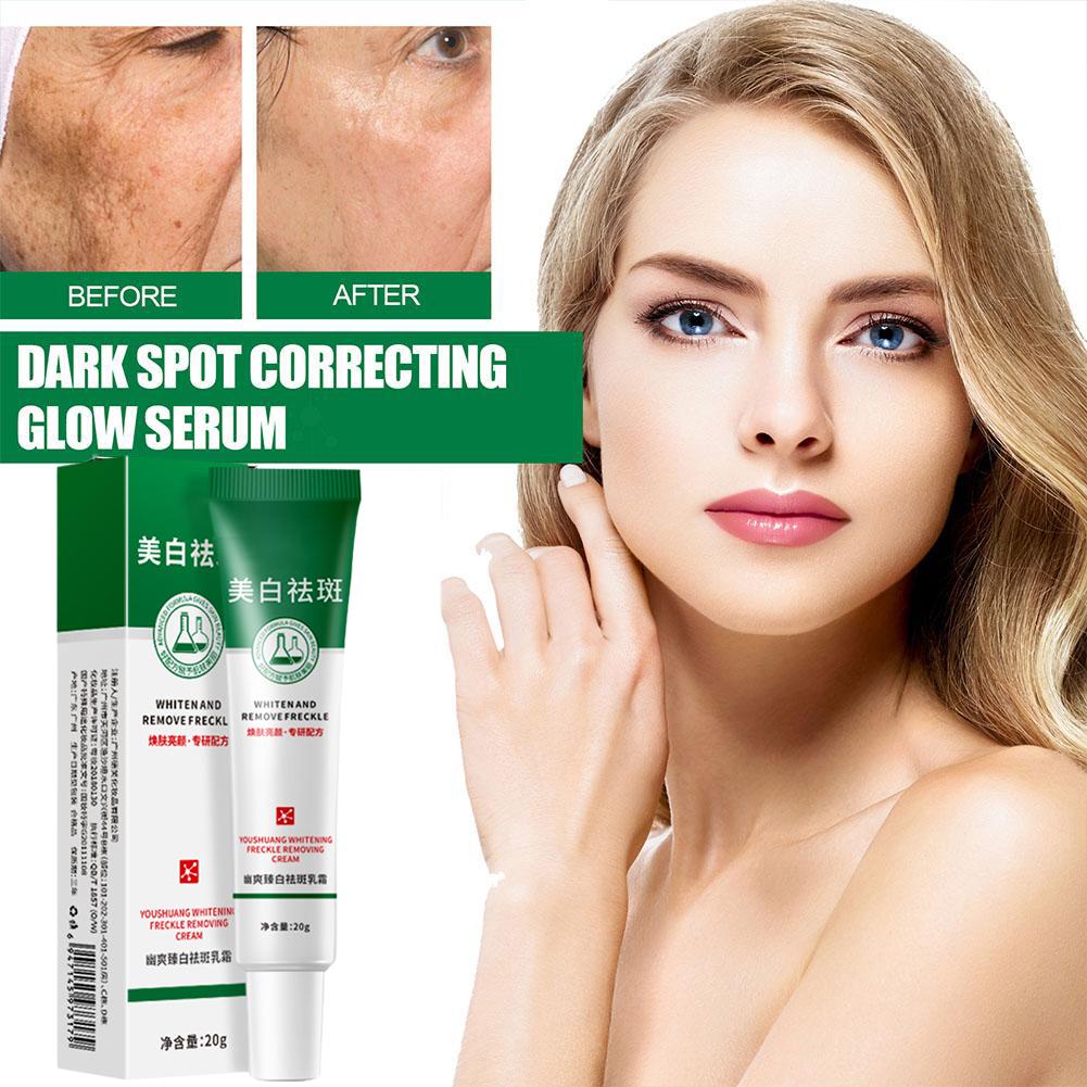 20 г отбеливающий крем от веснушек для удаления темных пятен на лице крем от мелазмы осветляет пигментацию лыжи P9L3
