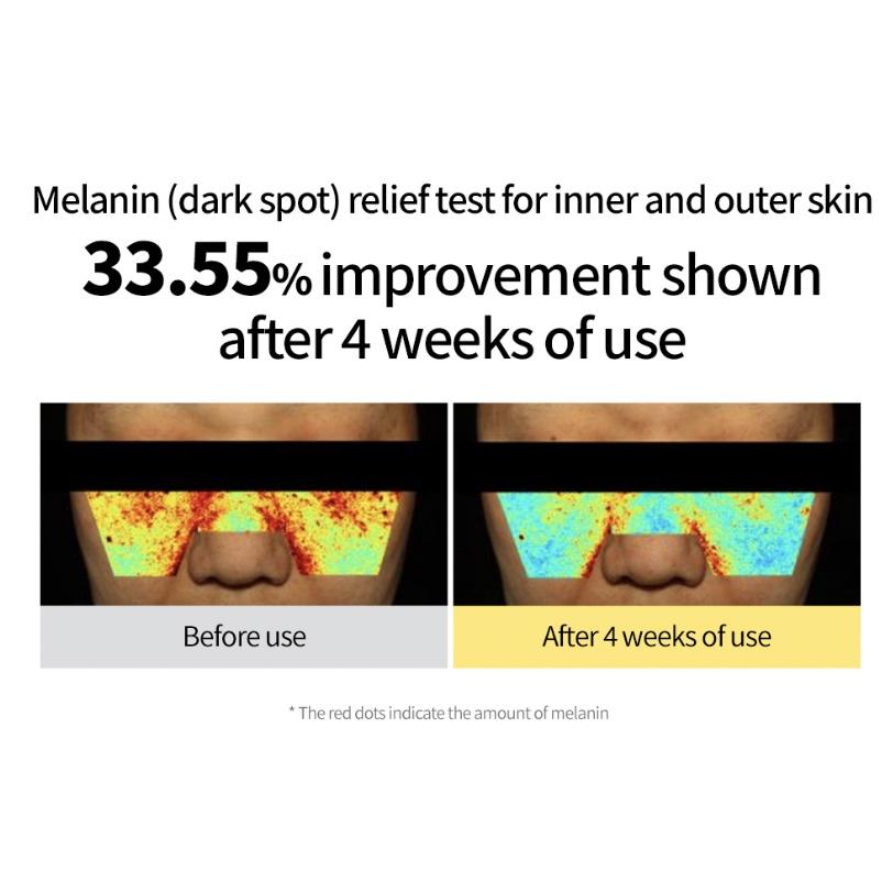 Goodal Vita C Сыворотка для ухода за темными пятнами/крем/тонизирующий крем/крем для глаз