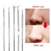 Nose Sebum Blackhead Removal Remover Tool Acne Blemish Extractor Pore Cleaner Face Cleansing Skin Care, BA2 Style B