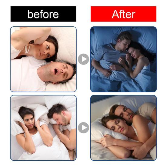 60 шт. Пластырь для сна против храпа, облегчающий заложенность носа, дышащий, гипоаллергенный, безболезненный, для снятия сна