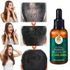 Hair Growth Essence, Hair Care Products, Hair Essence, Fast Hair Growth, Nourishing Hair, Moisturizing And Softening Hair Quality