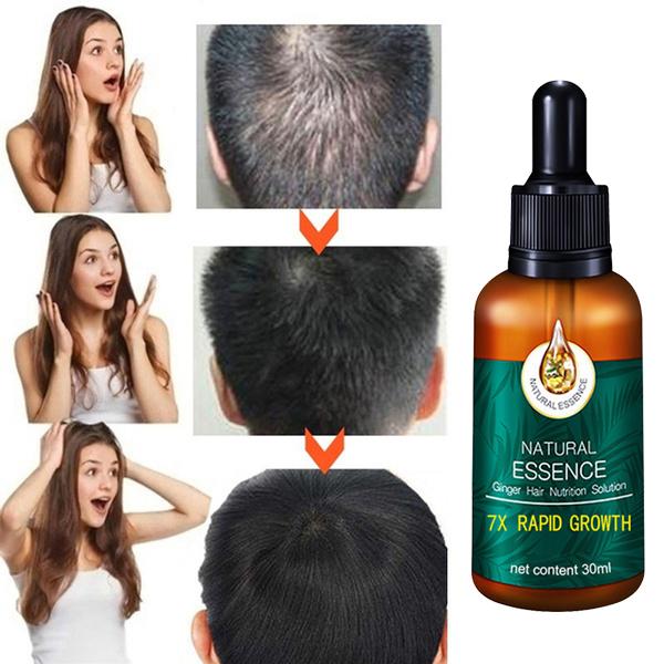 Hair Growth Essence, Hair Care Products, Hair Essence, Fast Hair Growth, Nourishing Hair, Moisturizing And Softening Hair Quality