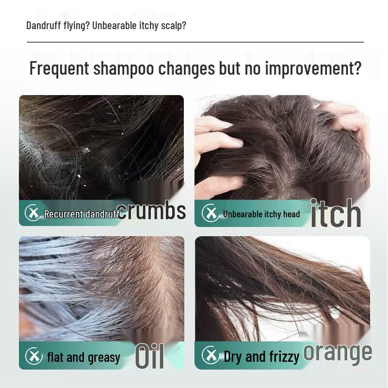 SLEK O₂ Dynamic Oil Control Anti-Dandruff Shampoo