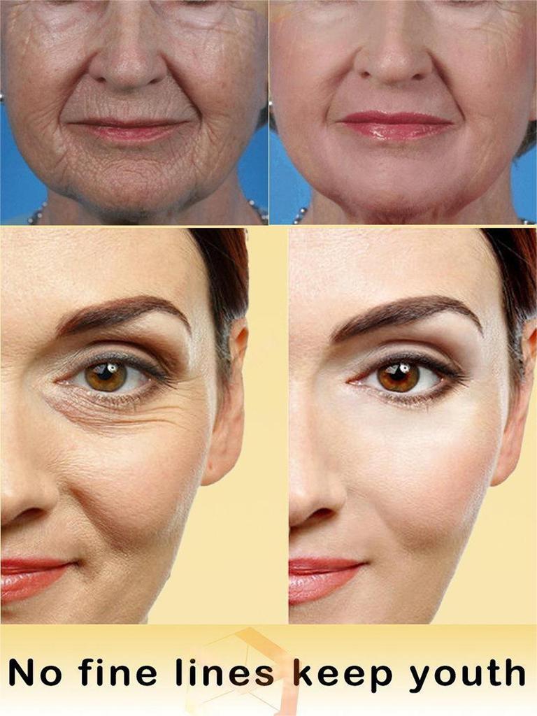 5ML/15ML/30ML/50ML/Anti Redness Solution ,Spider Vein Removal Advanced Treatment Clearer Skin Veins On Face