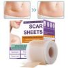1 шт. силиконовый гелевый пластырь для лечения шрамов, лечение ожогов ушей, лечение шрамов от угревой сыпи, травмы D9W3