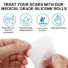 1 Roll White 1.5M Silicone Scar Removal Tape For Surgical Scars Medical Grade Scar Sheet Painless Scar Repair Tape Effective