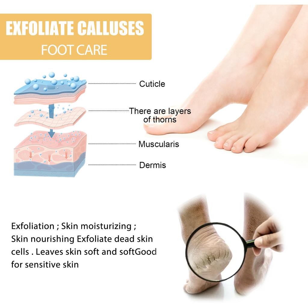 EELHOE Foot Peeling Spray Natural Orange Essence Pedicure Hands Dead Skin Exfoliator Mask Whiten Baby Foot Care Tool