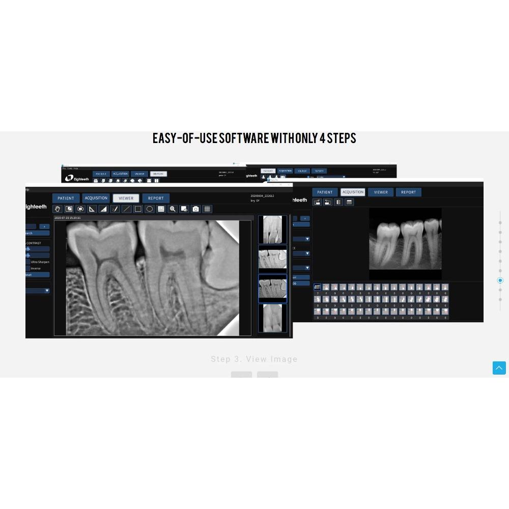 Стоматологический цифровой датчик Eighteeth NanoPix Портативная система визуализации Ветеринарные датчики Системы для аппаратов Рентгеновские инструменты