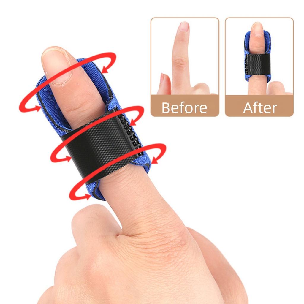 5Pcs Adjustable Finger Fixation Strap With Aluminum Strip Trigger Finger Splint Corrector Brace Finger Guard Sleeve For Support