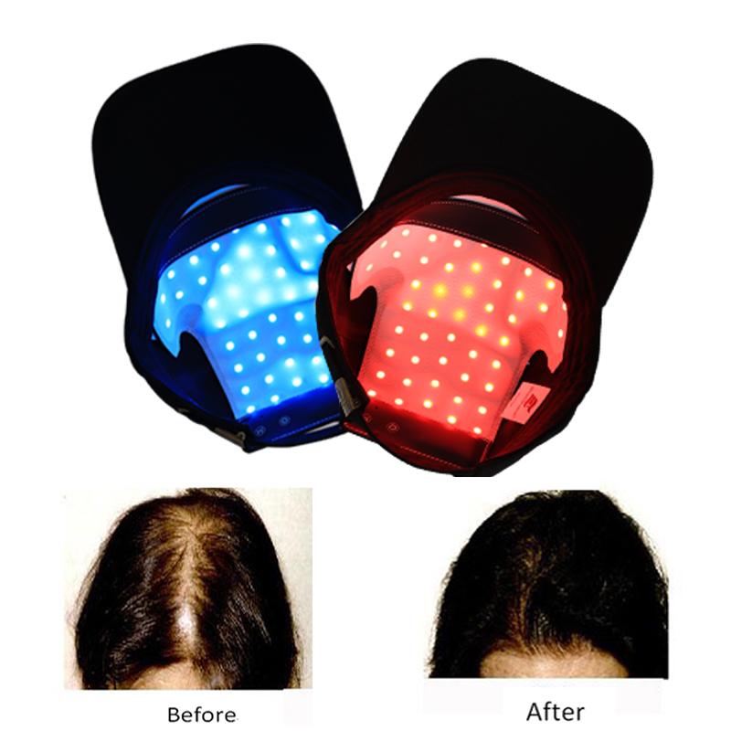 Лазерная терапия, шлем для роста волос, устройство против выпадения волос, колпачок для восстановления роста волос, 48 шт., лазер