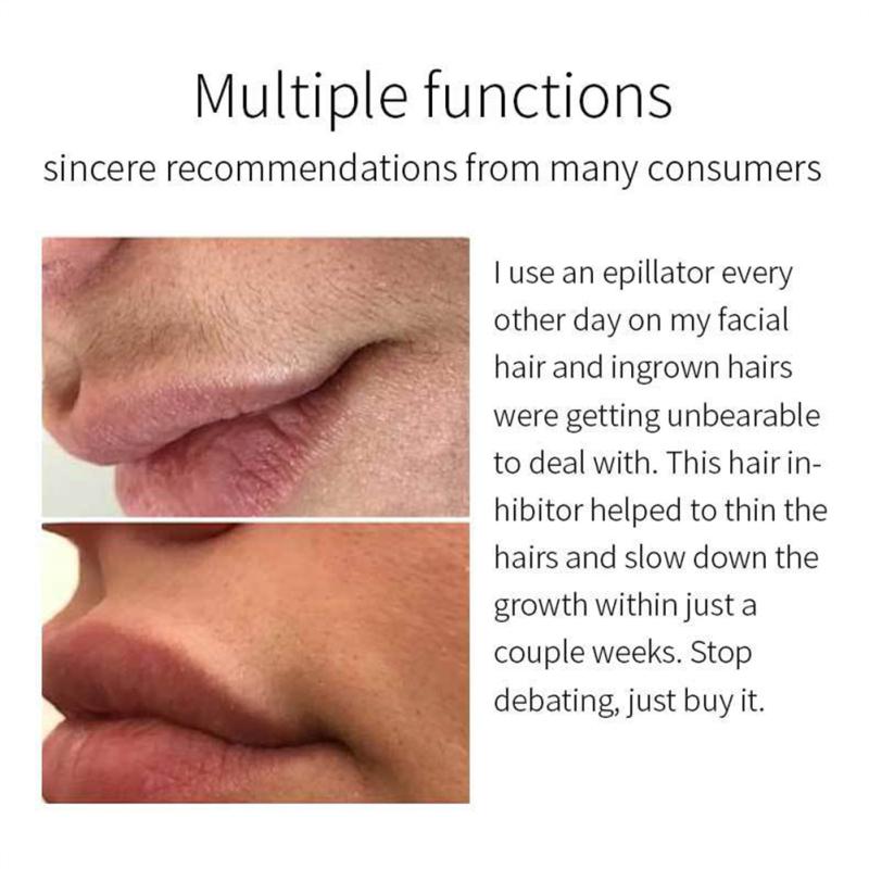 Ингибитор роста волос Лосьон для тела, подавляющий волосы Эффективное безболезненное удаление волос Увлажняющий