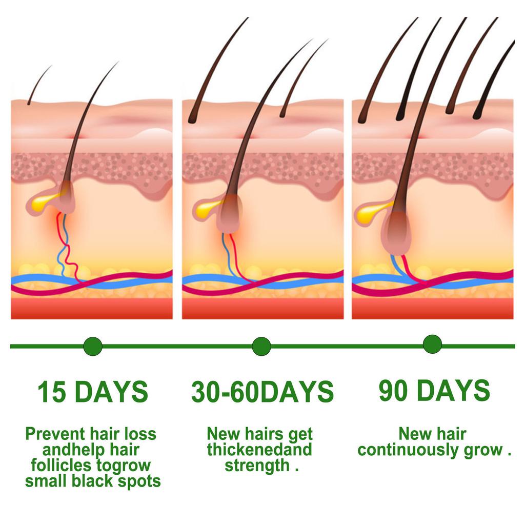 Rosemary Hair Growth Oil, Gentle Scalp Care, Smooth Shine, Natural Volume Treatment