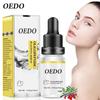 OEDO Oligopeptide Placenta Serum Face Cream Acne Treatment Skin Care Repair Whitening Anti Anging Winkles Essence Moisturizing