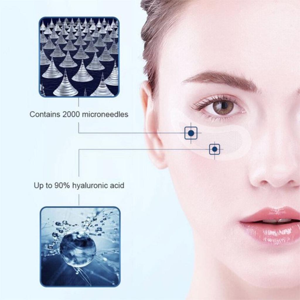 Гиалуроновые микроиглы для глаз, удаление морщин и тонких линий, 1 мл