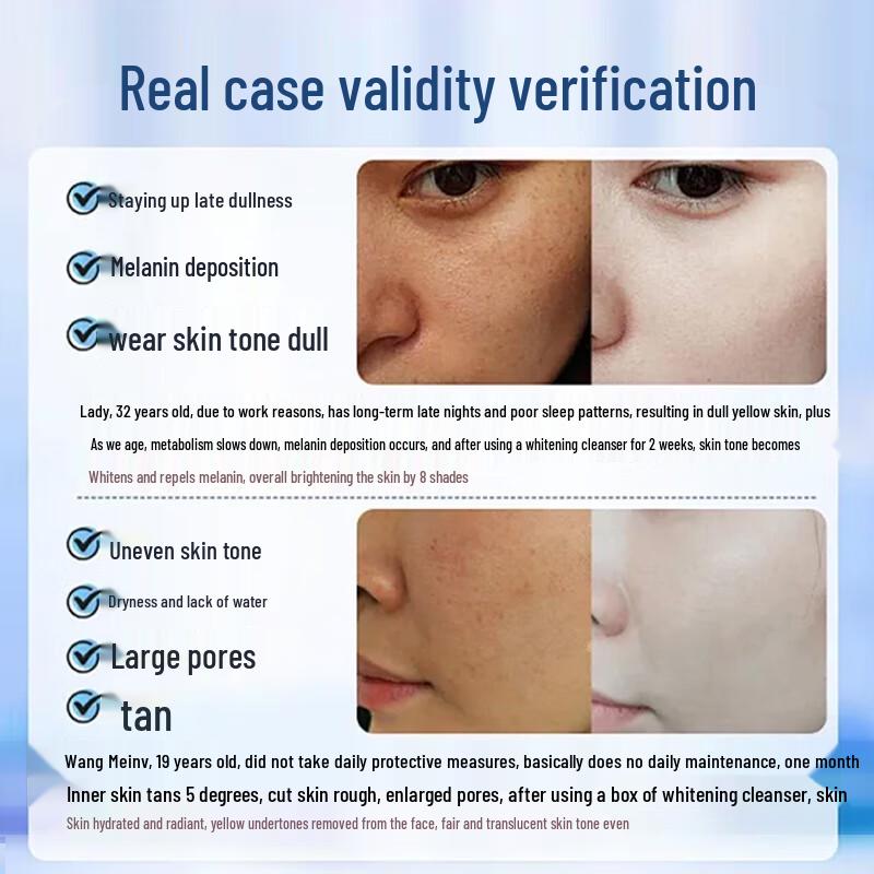 BEAI 577 Отбеливающая и осветляющая пигментные пятна аминокислотная пенка для умывания