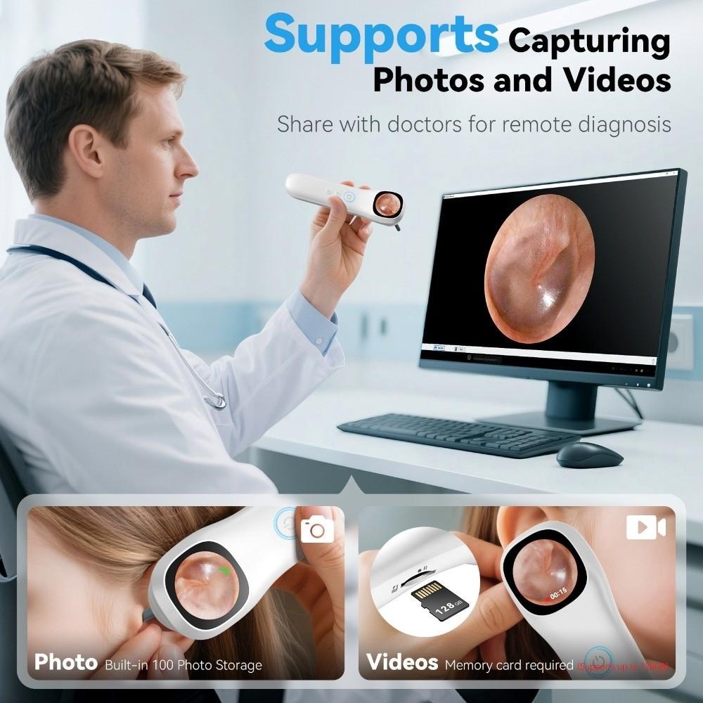 1.21 Inch IPS Screen Ear Camera 1080P HD Digital Ear Camera Durable Visual Ear Care Ear Care