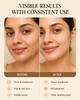 Очищающее средство для лица FOYU Skincare "CLEAR IT" против акне, с 2% салициловой кислоты и ниацинамидом, Удаляет прыщи и воспаления, Без парабенов и сульфатов,