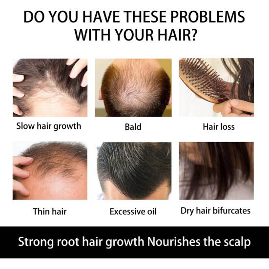 Ролик для роста волос, практичный, прочный, черный, женский, для домашнего использования, набор инструментов для красоты, принадлежности для ванной комнаты