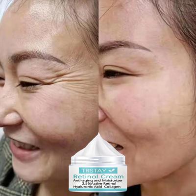 Крем с ретинолом, увлажняющий антивозрастной агент, 2,5% активный ретинол, гиалуроновая кислота, коллагеновый увлажняющий крем