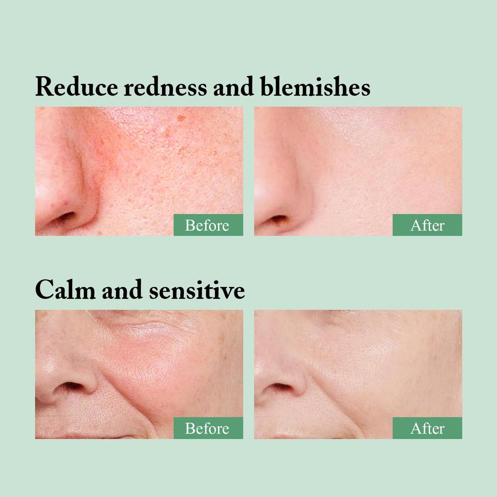 Тоник с Центеллой без спирта - Интенсивное питание - Увлажнение и очищение кожи - Подходит для всех типов кожи, 120 мл