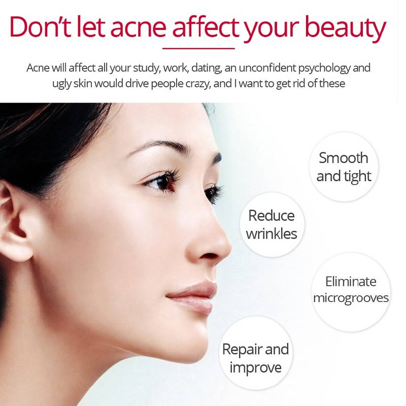 Сыворотка для лица с ретинолом, 30 мл, увлажняющая эссенция против морщин, омолаживающая отбеливающая эссенция для ухода за кожей лица