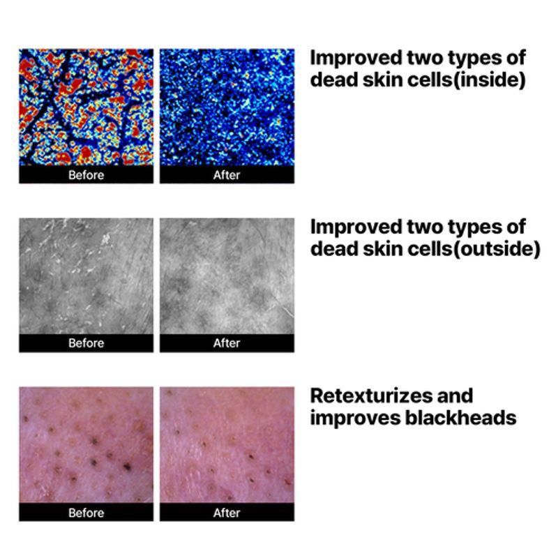 SOME BY MI *обновление* Lactosoy Мягкий пенящийся пилинг-гель 180 мл