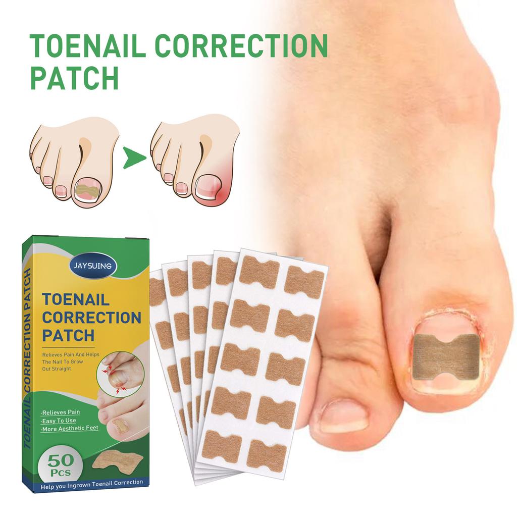 50pcs/Box Ingrown Toenail Sticker Toenail Correction Patch Tools Kit Nail Treatment Foot