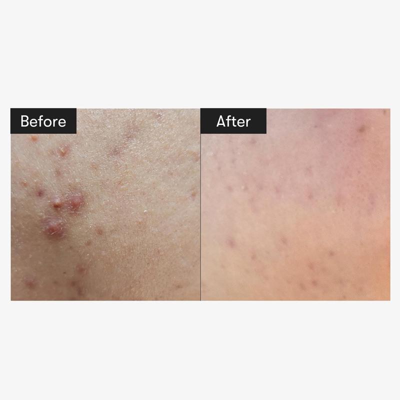 VT COSMETICS Ридл Шот 100 50мл