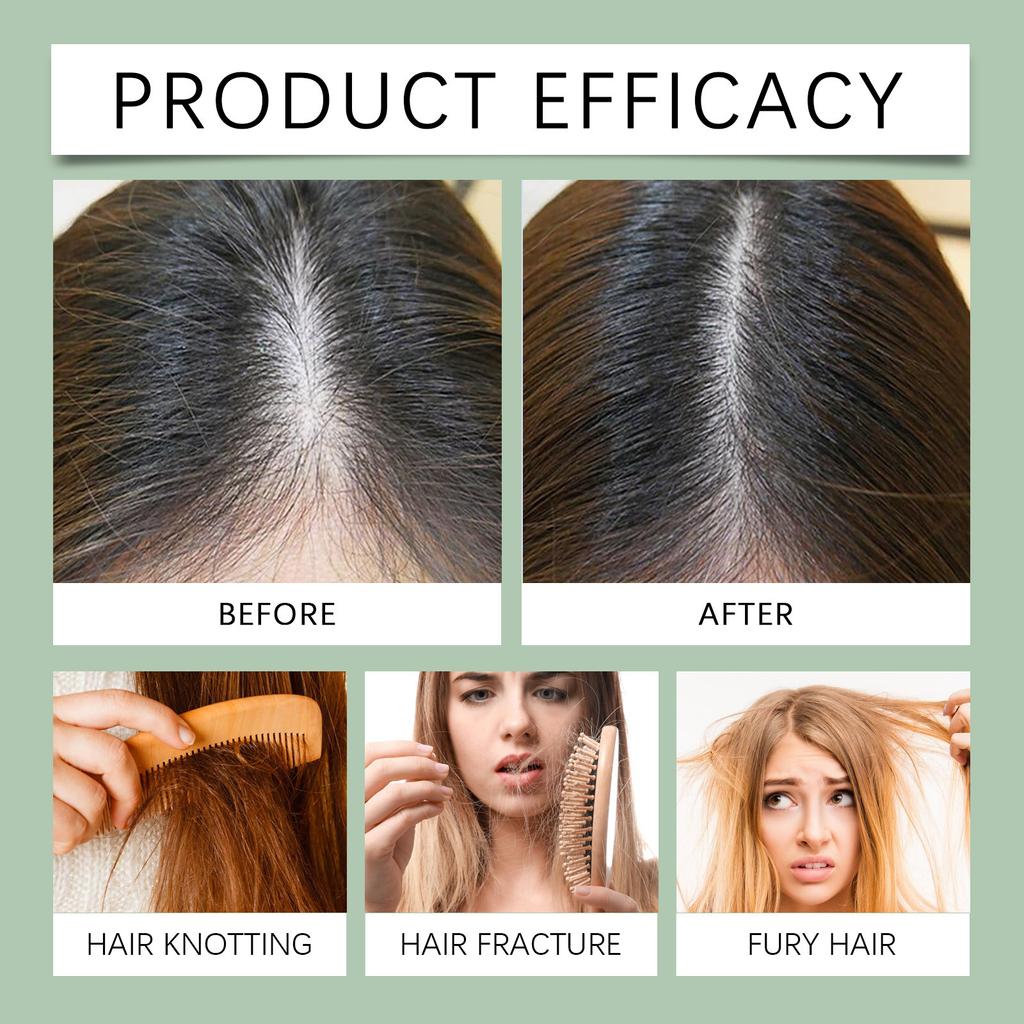 Thickening Hair Oil Effectively Nourishes Hair And Promotes Growth. Suitable For Continued Use To Maintain Hair Health,100ML