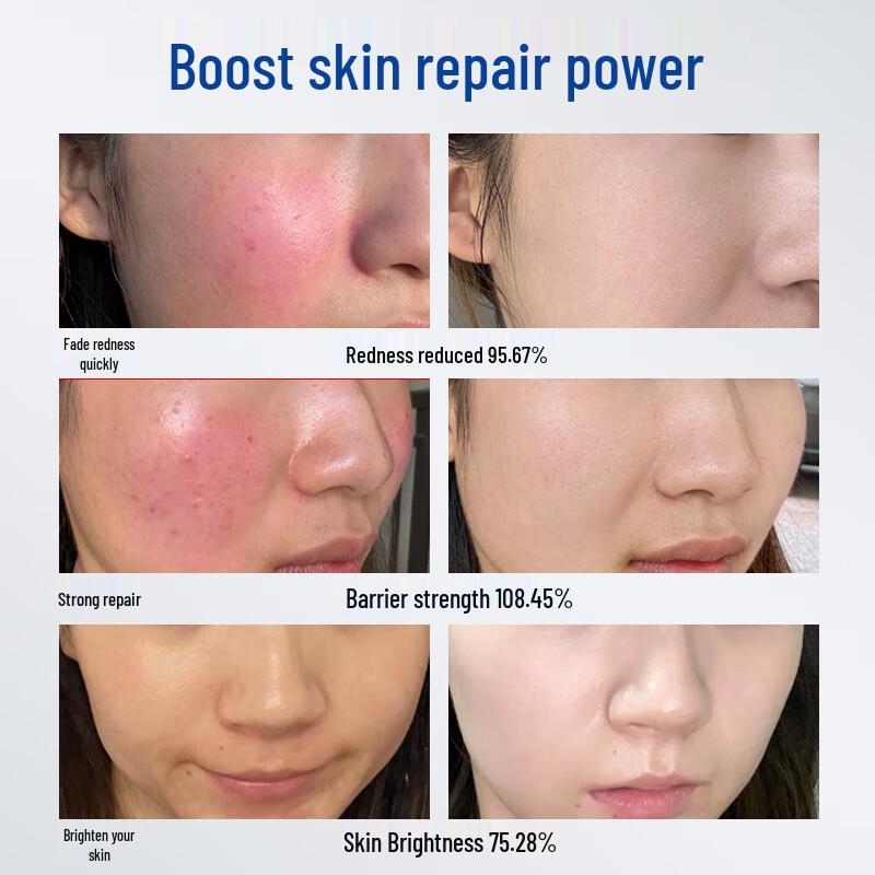 Naxi Multi-Peptide Skin Repair & Soothing Freeze-Dried Powder Set