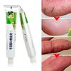 Powerful Hand Foot Crack Cream Heel Chapped Peeling Skin Care Chinese Ointment