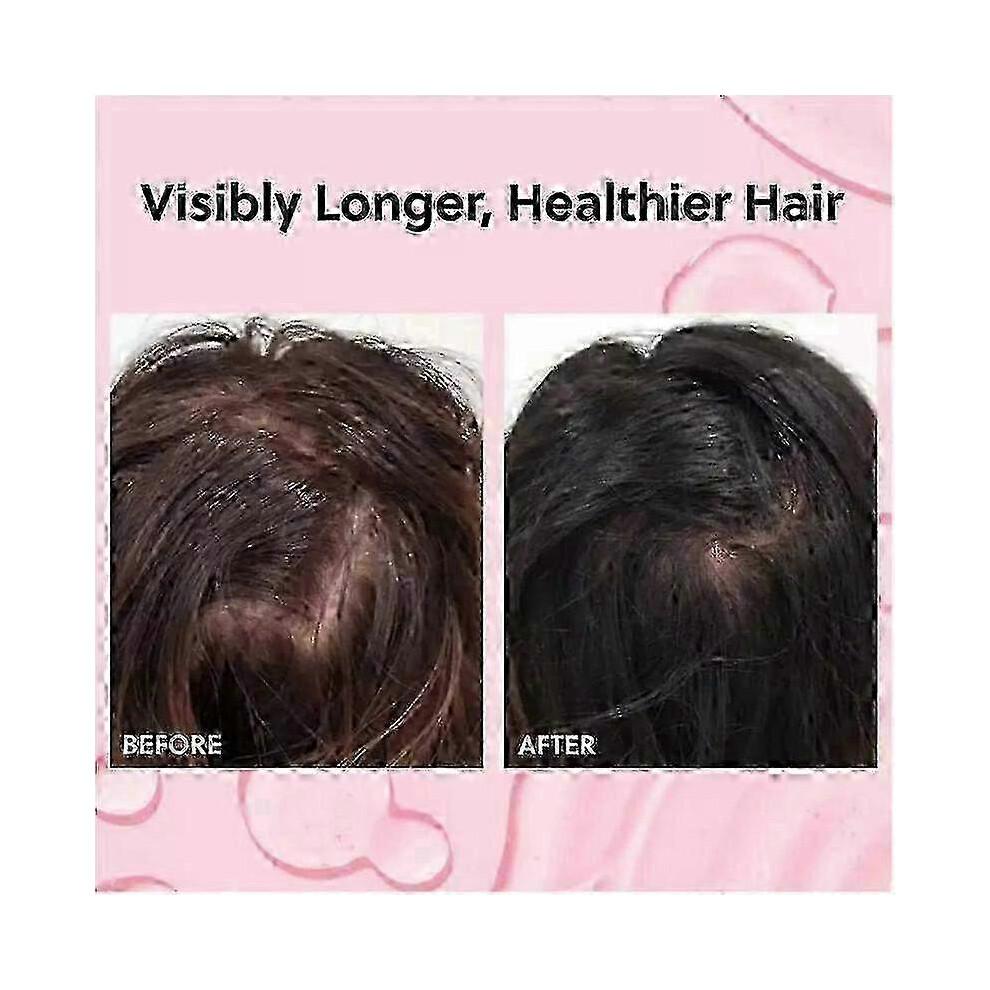 Hair Growth Oil Spray -non-greasy Hormone Free Formula - Promotes Thick
