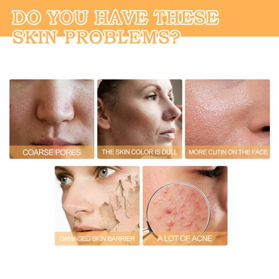 Тонизирующий раствор, не вызывающий раздражения, удаляет прыщи, эффективен, практичен, осветляет пятна, освежающий тоник для лица, уход за кожей