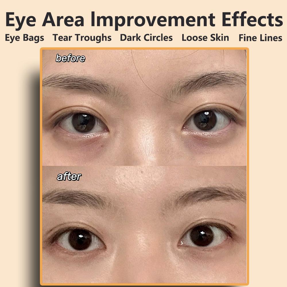 Wireless Remote Control EMS Eye Face Beauty Massage Muscle Stimulator Facial Lifting Anti-Wrinkle Lift Face Skin Care Dark Circles Relieves Fatigue