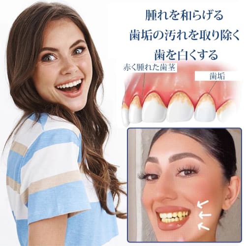 Гель для терапии десен при рецессии десен, Гель для ухода за деснами, Отбеливающий эссенциальный карандаш для зубов, Пародонтологический профессиональный уход, Межзубный гель, Гель для ухода за деснами, Восстанавливает и защищает