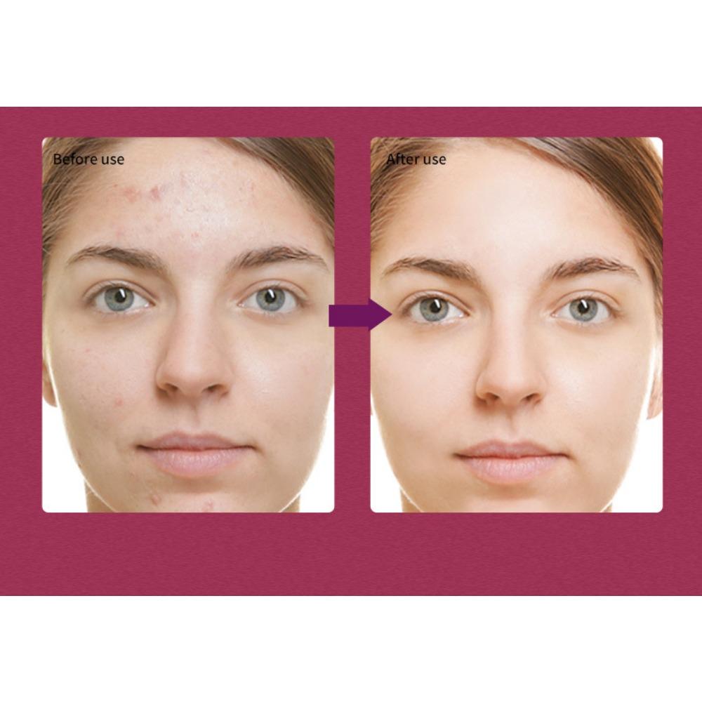 Fruit Acid Essence Fine Pore Cleansing Skin Brightening Skin Skin Softening Corneous Skin Care Product Liquid