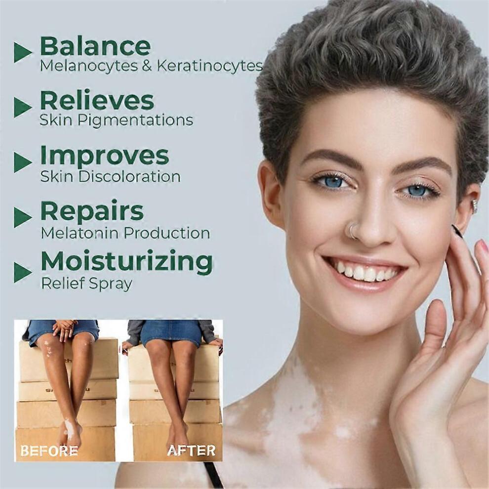 2pcs Vitiligo Skin Repair Cream,Vitiligo Treatment Cream, Dispose of White Spots on Skin and Improve Skin Pigmentation
