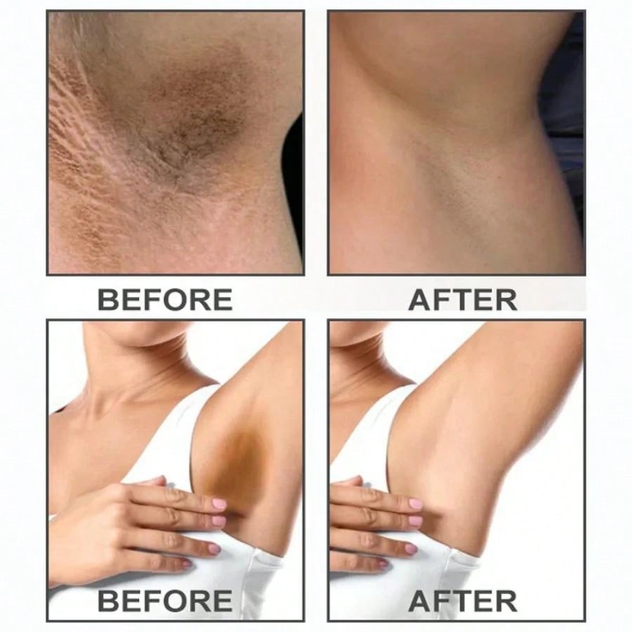 Skin Lightening, Whitening, Brightening Complexion, Armpit Knees, Elbow Moisturizing Cream, Moisturizing and Lightening Black Skin Concealer.