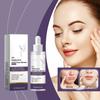 Hyaluronic Facial Moisturizing Replenishes Water, Soothes And Soothes Red Blood And Deeply Nourishes The Skin 30ml