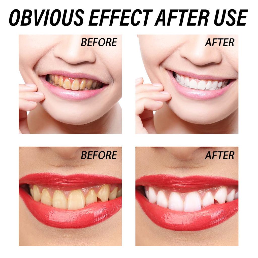 Отбеливающая зубная паста, уход за деснами, чистые пятна, желтые зубы, зубной камень, удаление запаха изо рта, предотвращение разрушения зубов, свежее дыхание, ремонт зубов.